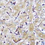 Immunohistochemistry - Anti-SERINC1 Antibody (A305807) - Antibodies.com