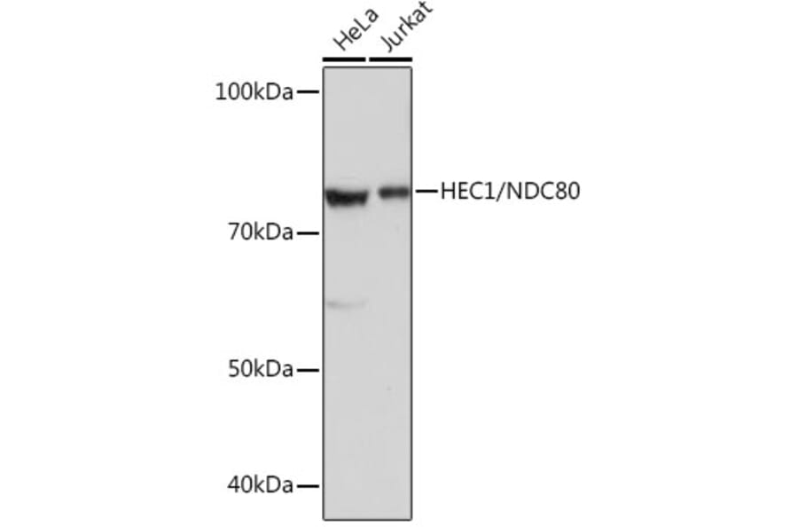 Western Blot - Anti-HEC1/HEC Antibody [ARC0741] (A305808) - Antibodies.com