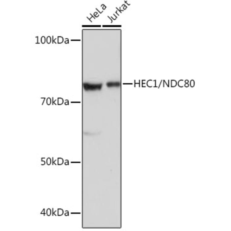 Western Blot - Anti-HEC1/HEC Antibody [ARC0741] (A305808) - Antibodies.com