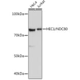 Western Blot - Anti-HEC1/HEC Antibody [ARC0741] (A305808) - Antibodies.com