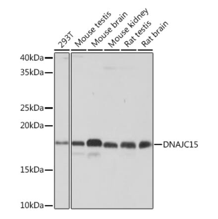 Western Blot - Anti-MCJ Antibody [ARC0249] (A305809) - Antibodies.com