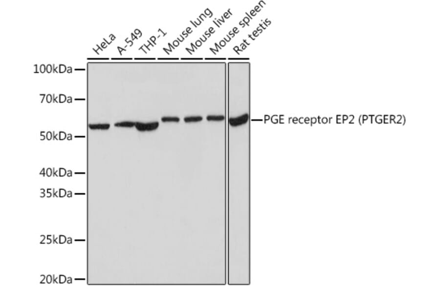 Western Blot - Anti-Prostaglandin E Receptor EP2/PTGER2 Antibody [ARC1393] (A305810) - Antibodies.com