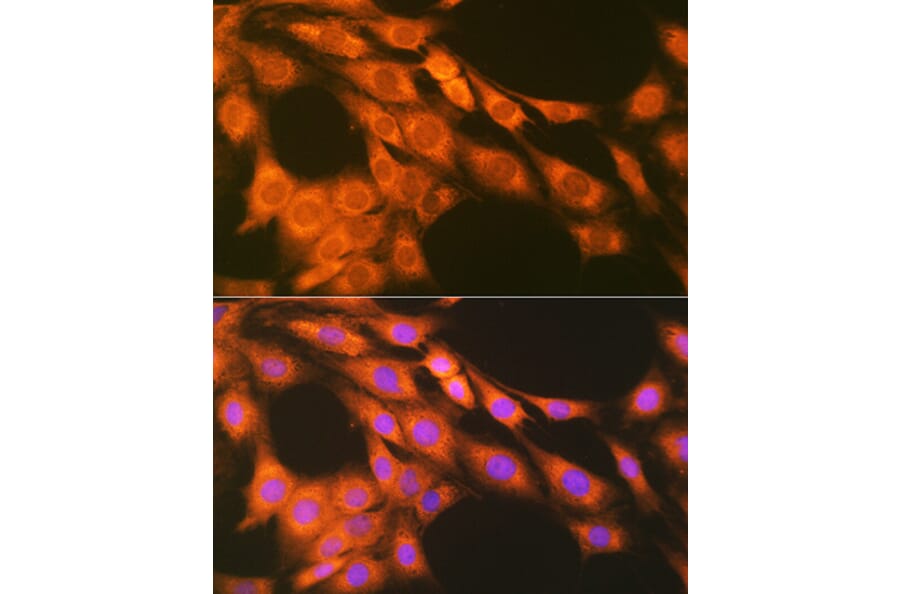Immunofluorescence - Anti-Prostaglandin E Receptor EP2/PTGER2 Antibody [ARC1393] (A305810) - Antibodies.com