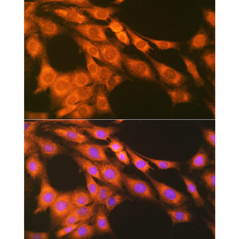 Immunofluorescence - Anti-Prostaglandin E Receptor EP2/PTGER2 Antibody [ARC1393] (A305810) - Antibodies.com