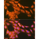 Immunofluorescence - Anti-Prostaglandin E Receptor EP2/PTGER2 Antibody [ARC1393] (A305810) - Antibodies.com