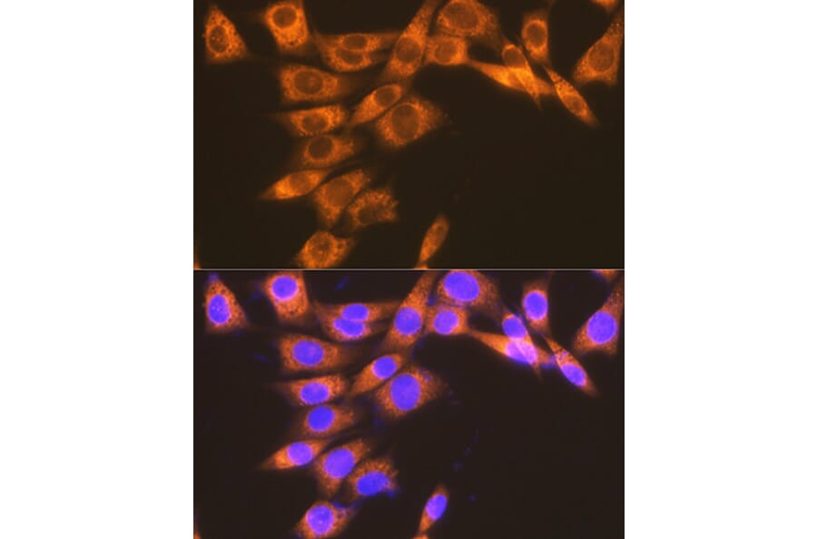 Immunofluorescence - Anti-Prostaglandin E Receptor EP2/PTGER2 Antibody [ARC1393] (A305810) - Antibodies.com