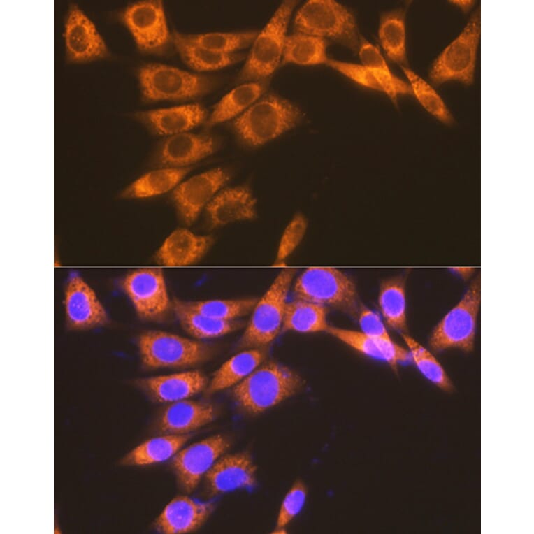 Immunofluorescence - Anti-Prostaglandin E Receptor EP2/PTGER2 Antibody [ARC1393] (A305810) - Antibodies.com
