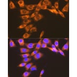Immunofluorescence - Anti-Prostaglandin E Receptor EP2/PTGER2 Antibody [ARC1393] (A305810) - Antibodies.com