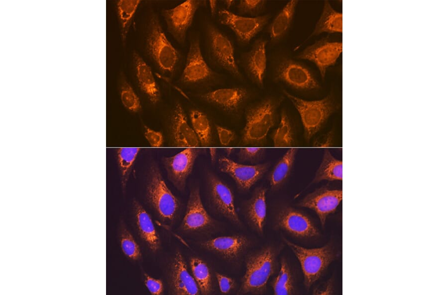 Immunofluorescence - Anti-Prostaglandin E Receptor EP2/PTGER2 Antibody [ARC1393] (A305810) - Antibodies.com