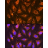 Immunofluorescence - Anti-Prostaglandin E Receptor EP2/PTGER2 Antibody [ARC1393] (A305810) - Antibodies.com