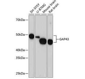 Western Blot - Anti-GAP43 Antibody [ARC0246] (A305811) - Antibodies.com