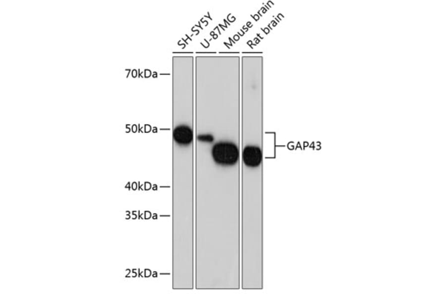 Western Blot - Anti-GAP43 Antibody [ARC0246] (A305811) - Antibodies.com