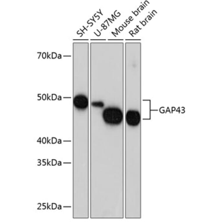 Western Blot - Anti-GAP43 Antibody [ARC0246] (A305811) - Antibodies.com