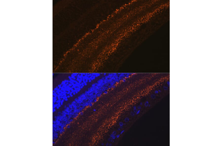 Immunofluorescence - Anti-GAP43 Antibody [ARC0246] (A305811) - Antibodies.com