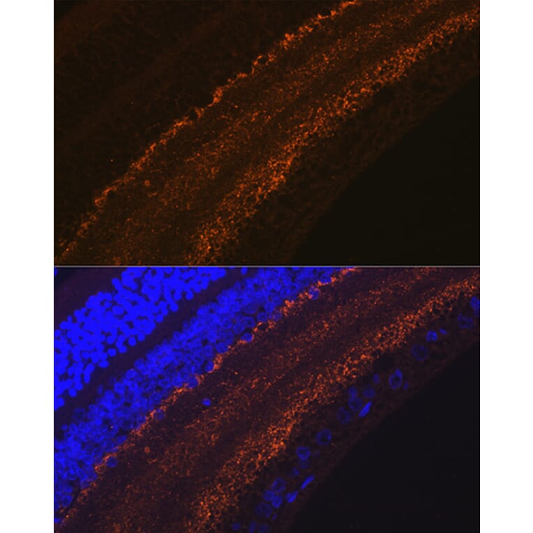 Immunofluorescence - Anti-GAP43 Antibody [ARC0246] (A305811) - Antibodies.com