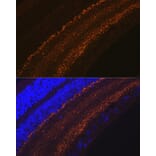 Immunofluorescence - Anti-GAP43 Antibody [ARC0246] (A305811) - Antibodies.com