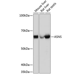 Western Blot - Anti-Asparagine synthetase Antibody [ARC0517] (A305812) - Antibodies.com