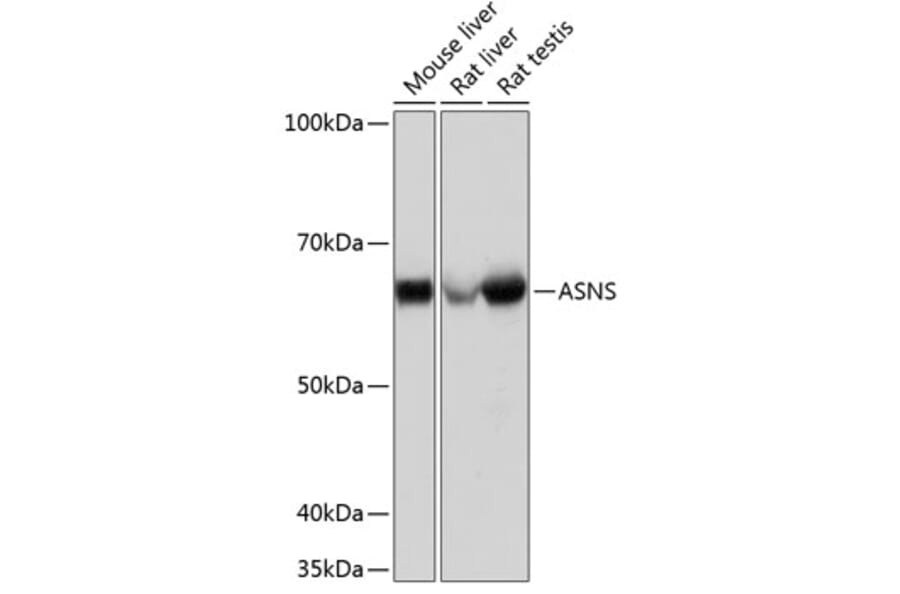 Western Blot - Anti-Asparagine synthetase Antibody [ARC0517] (A305812) - Antibodies.com