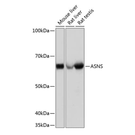 Western Blot - Anti-Asparagine synthetase Antibody [ARC0517] (A305812) - Antibodies.com