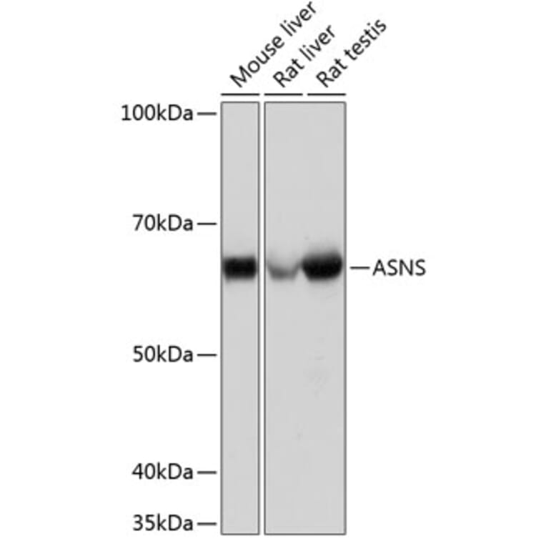 Western Blot - Anti-Asparagine synthetase Antibody [ARC0517] (A305812) - Antibodies.com