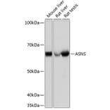 Western Blot - Anti-Asparagine synthetase Antibody [ARC0517] (A305812) - Antibodies.com