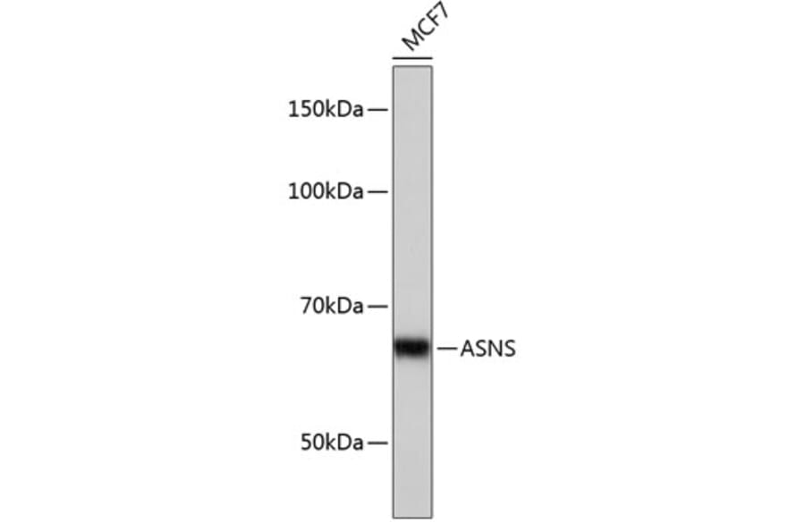 Western Blot - Anti-Asparagine synthetase Antibody [ARC0517] (A305812) - Antibodies.com