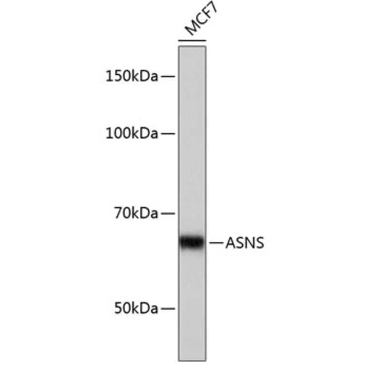 Western Blot - Anti-Asparagine synthetase Antibody [ARC0517] (A305812) - Antibodies.com