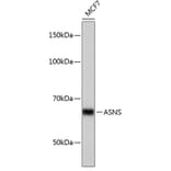 Western Blot - Anti-Asparagine synthetase Antibody [ARC0517] (A305812) - Antibodies.com