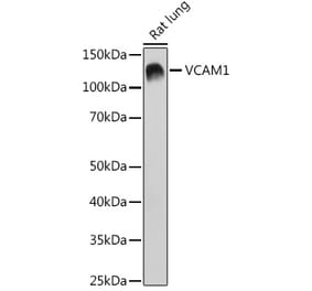 Western Blot - Anti-VCAM1 Antibody [ARC0312] (A305813) - Antibodies.com