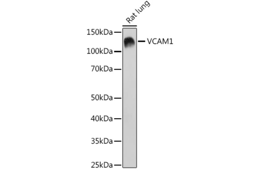 Western Blot - Anti-VCAM1 Antibody [ARC0312] (A305813) - Antibodies.com