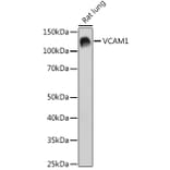 Western Blot - Anti-VCAM1 Antibody [ARC0312] (A305813) - Antibodies.com