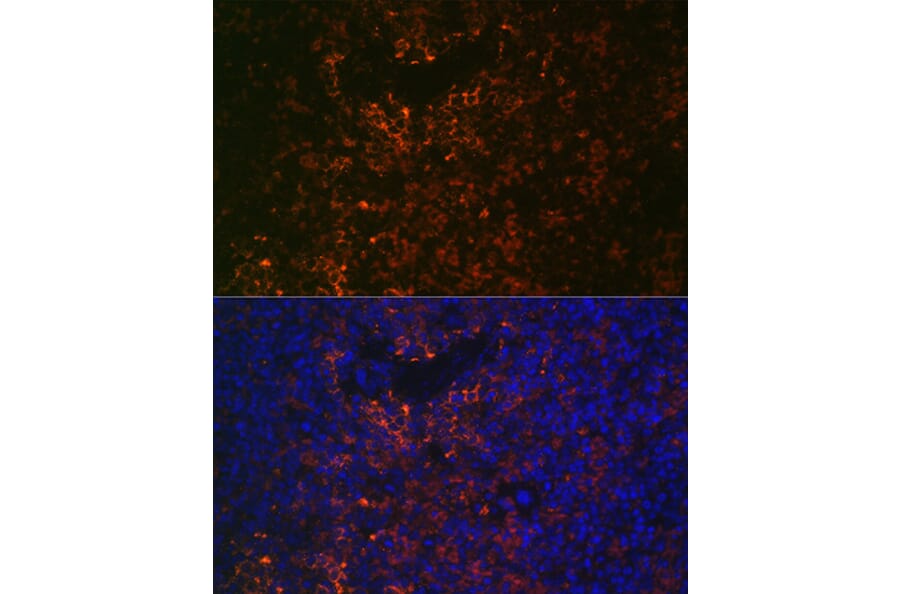 Immunofluorescence - Anti-VCAM1 Antibody (A305813) - Antibodies.com