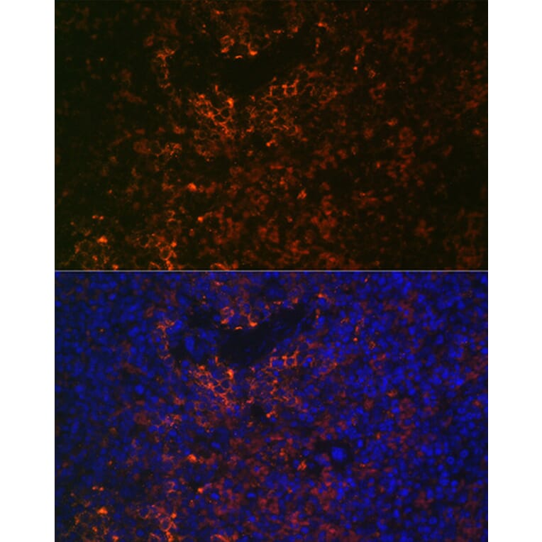 Immunofluorescence - Anti-VCAM1 Antibody (A305813) - Antibodies.com