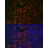Immunofluorescence - Anti-VCAM1 Antibody (A305813) - Antibodies.com