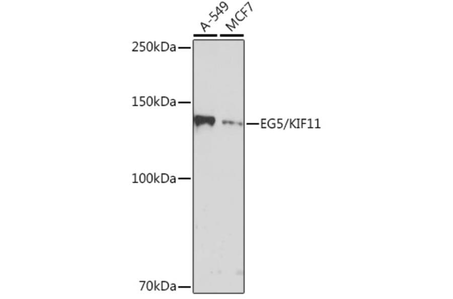 Western Blot - Anti-Eg5 Antibody [ARC1080] (A305814) - Antibodies.com