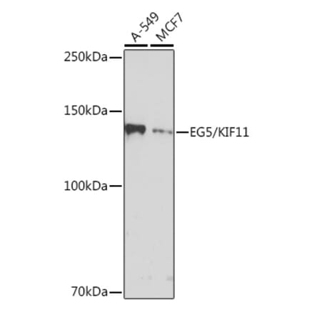 Western Blot - Anti-Eg5 Antibody [ARC1080] (A305814) - Antibodies.com