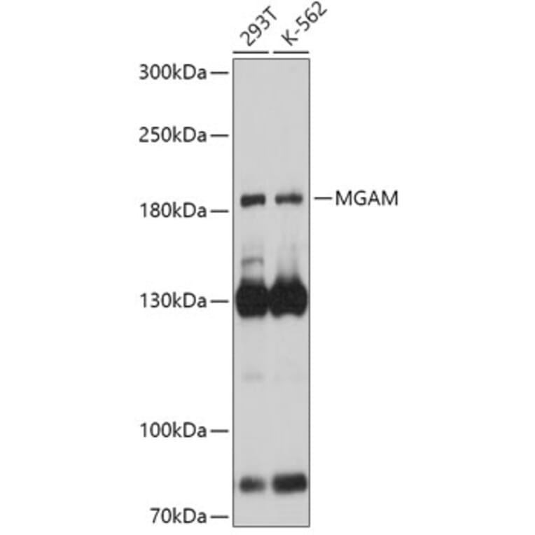 Western Blot - Anti-MGAM Antibody (A305815) - Antibodies.com
