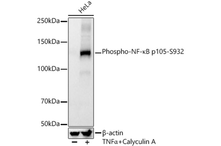 Western Blot - Anti-NFkB p105 (phospho Ser932) Antibody [ARC55043] (A305816) - Antibodies.com