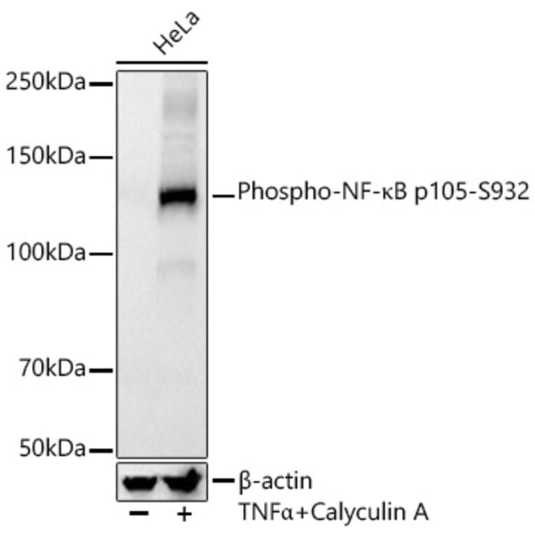 Western Blot - Anti-NFkB p105 (phospho Ser932) Antibody [ARC55043] (A305816) - Antibodies.com