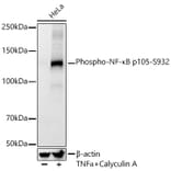 Western Blot - Anti-NFkB p105 (phospho Ser932) Antibody [ARC55043] (A305816) - Antibodies.com