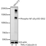 Western Blot - Anti-NFkB p105 (phospho Ser932) Antibody [ARC55043] (A305816) - Antibodies.com