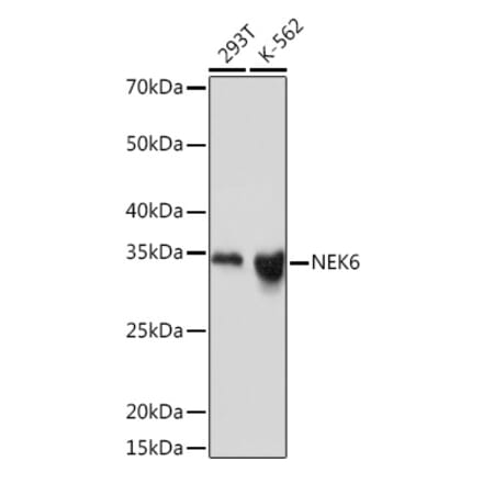 Western Blot - Anti-NEK6 Antibody [ARC2034] (A305818) - Antibodies.com