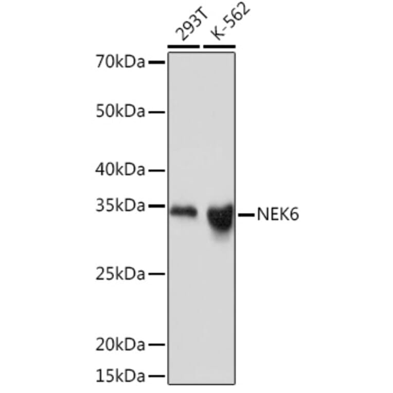 Western Blot - Anti-NEK6 Antibody [ARC2034] (A305818) - Antibodies.com