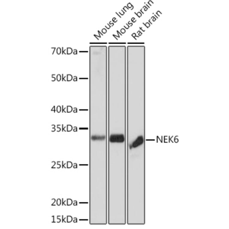 Western Blot - Anti-NEK6 Antibody [ARC2034] (A305818) - Antibodies.com