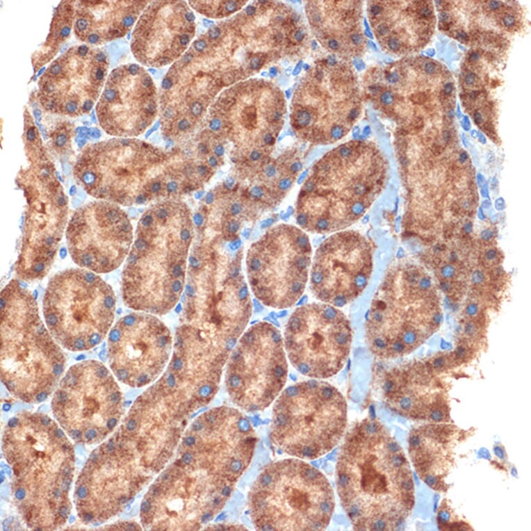 Immunohistochemistry - Anti-NEK6 Antibody [ARC2034] (A305818) - Antibodies.com