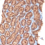 Immunohistochemistry - Anti-NEK6 Antibody [ARC2034] (A305818) - Antibodies.com