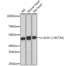 Western Blot - Anti-muscle Actin Antibody [ARC1912] (A305819) - Antibodies.com