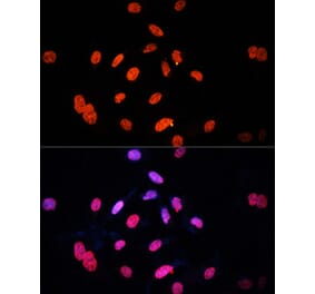 Immunofluorescence - Anti-E2F1 Antibody (A305820) - Antibodies.com