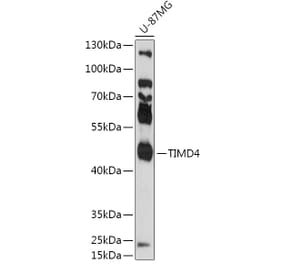 Western Blot - Anti-TIM 4 Antibody (A305821) - Antibodies.com