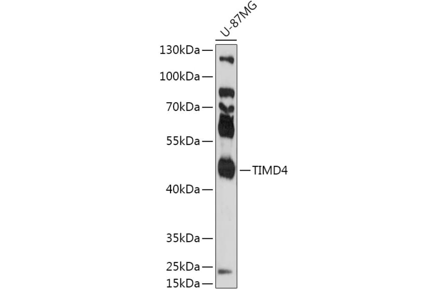Western Blot - Anti-TIM 4 Antibody (A305821) - Antibodies.com